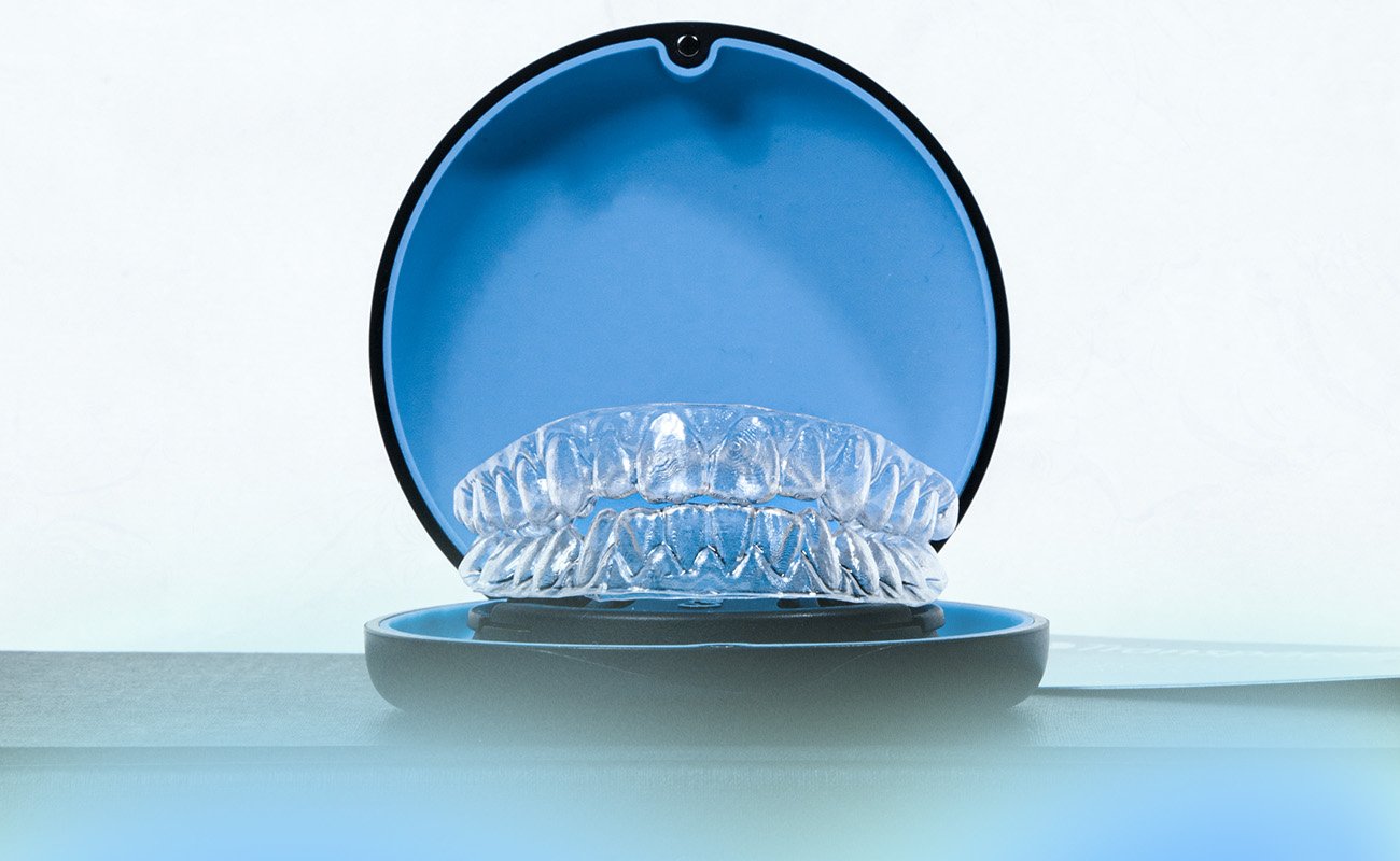 Alternative To Braces For Adults