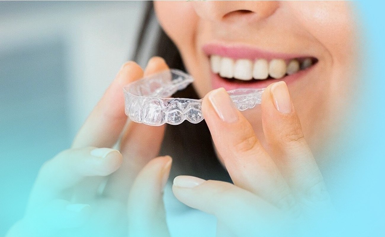Invisible Braces How Do They Work?