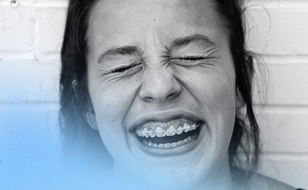 What Is The Difference Between Braces And Retainers