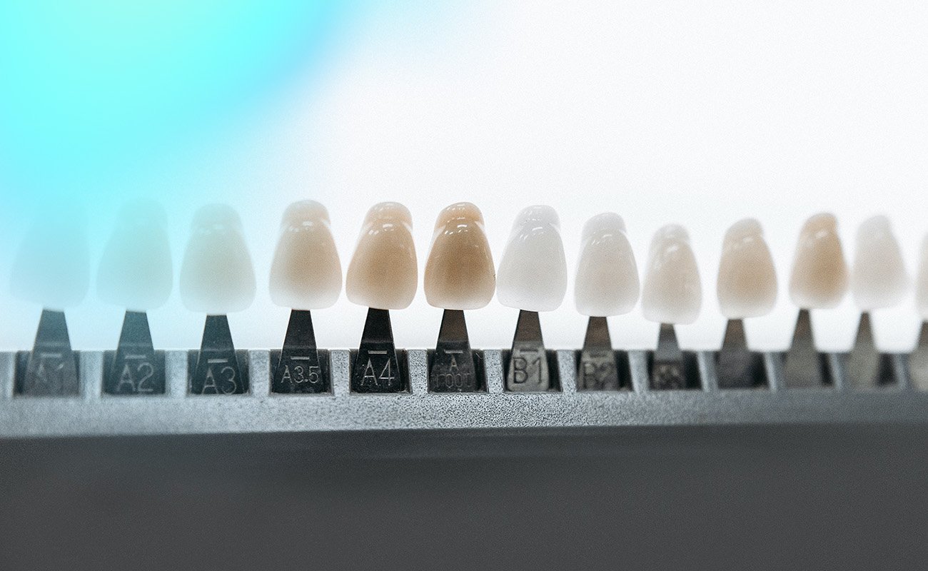 cheaper option to veneers