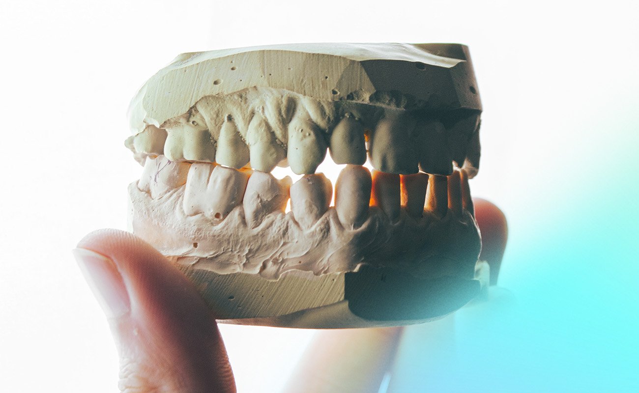 i don't like my teeth