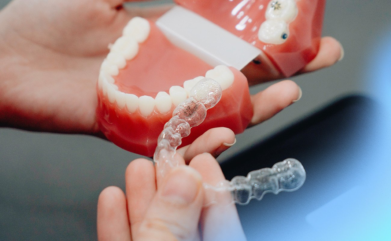 invisalign with missing tooth