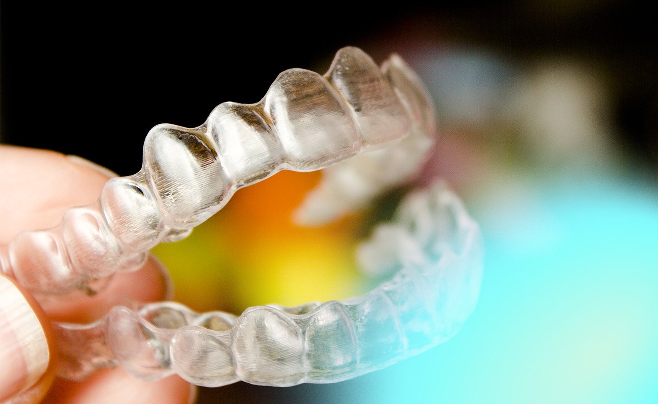 Nighttime Aligners Before and After