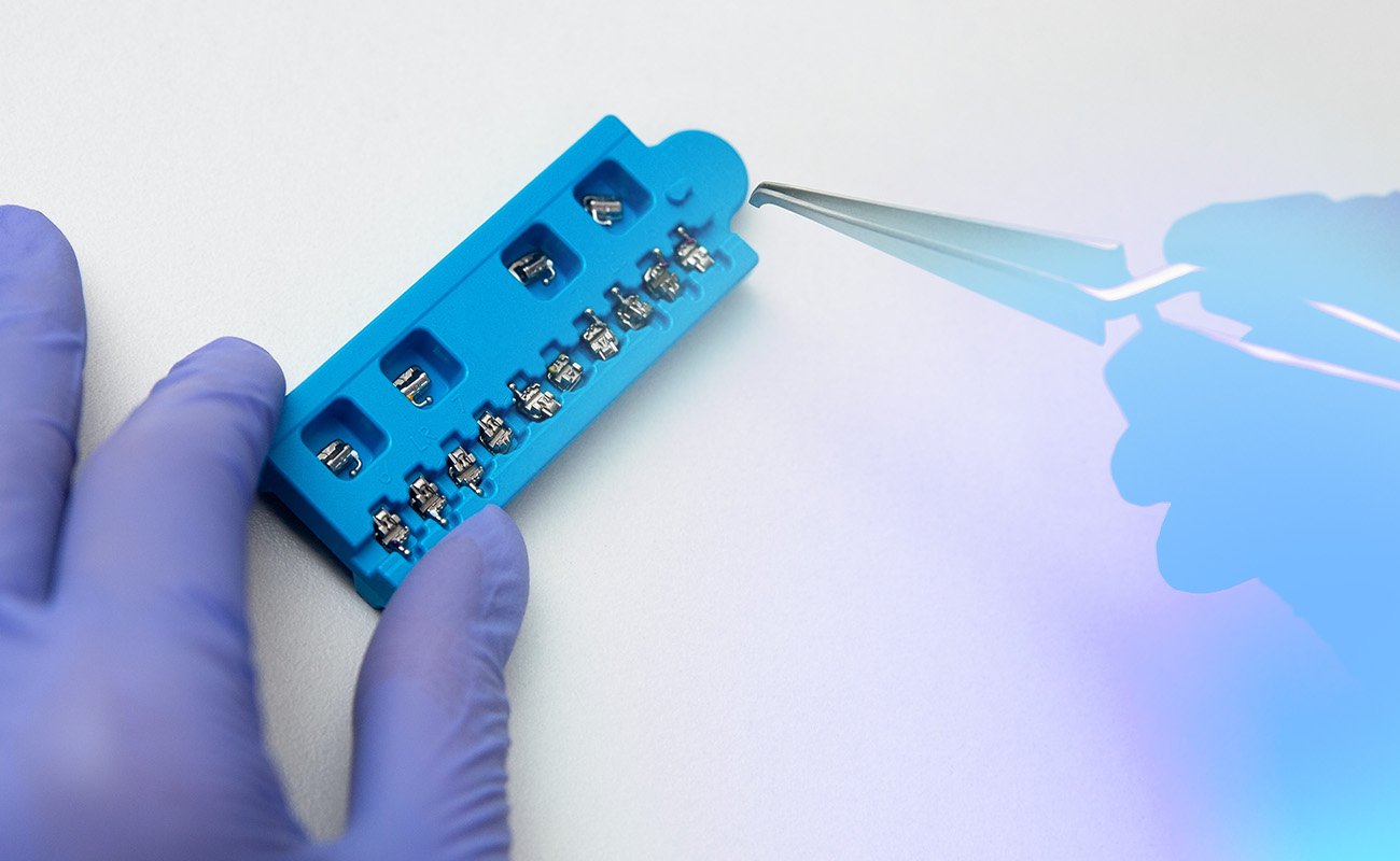 options to straighten teeth