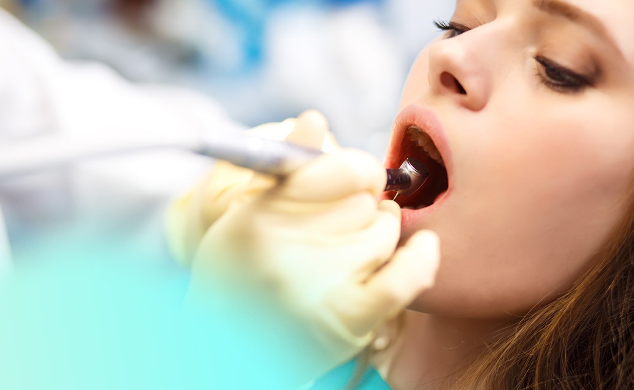 Does a Root Canal Hurt with Laughing Gas?