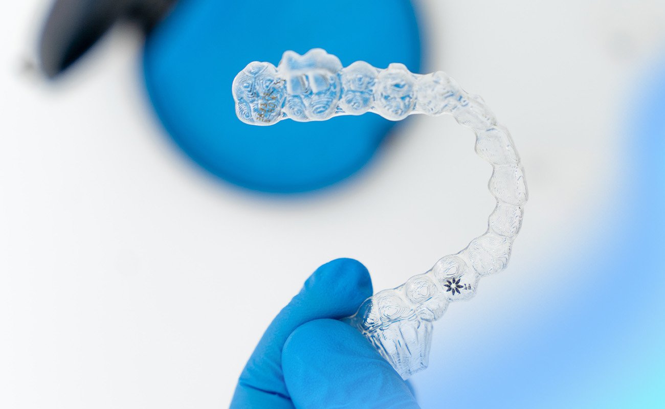 How Many Aligners for Invisalign