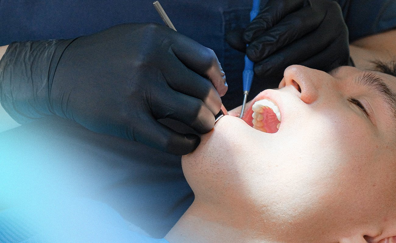 How Often Should You Get Your Teeth Cleaned