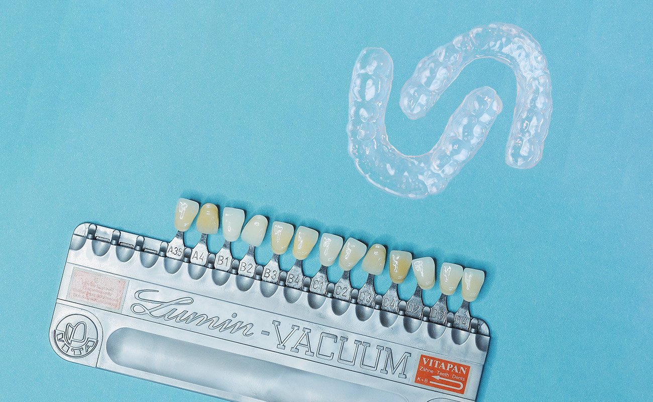 Invisalign and Veneers