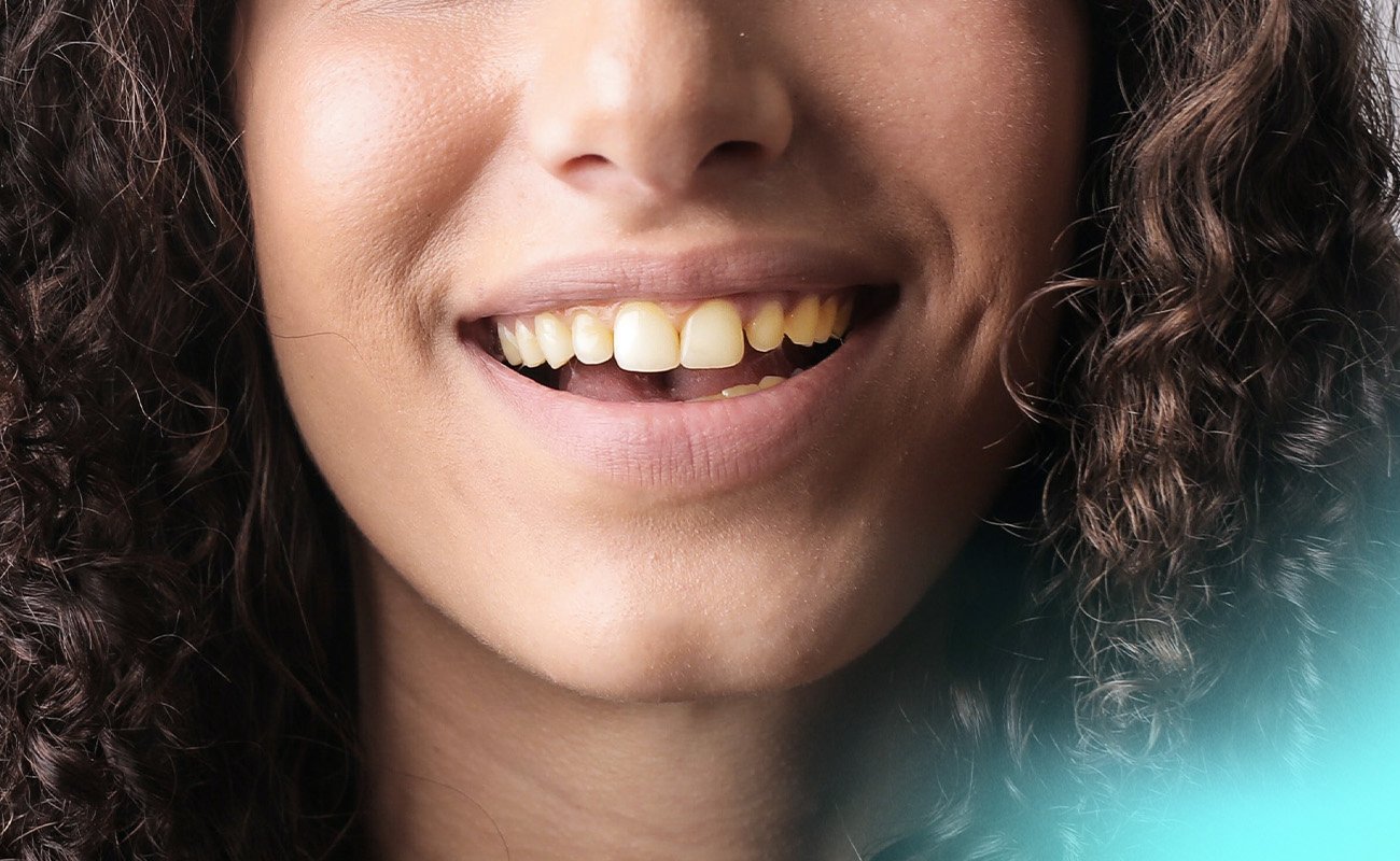 teeth discoloration vitamin deficiency